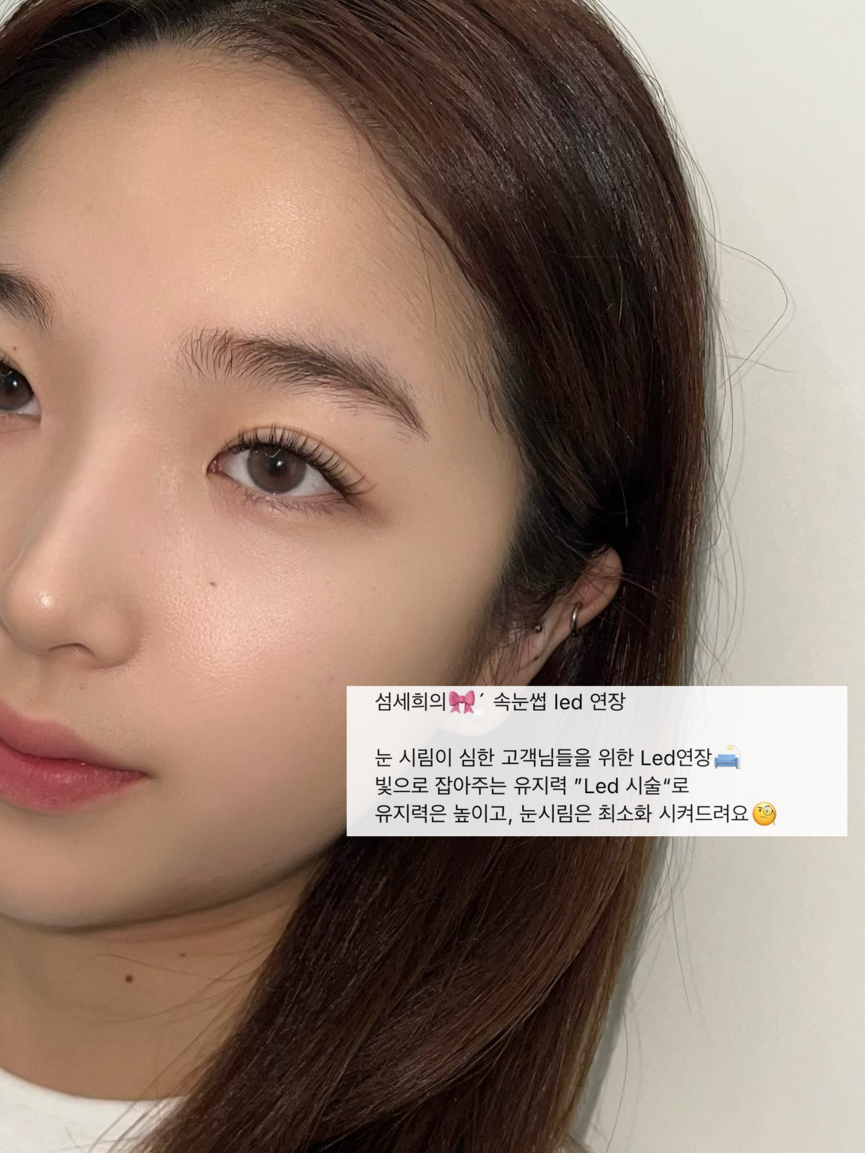 섬세희