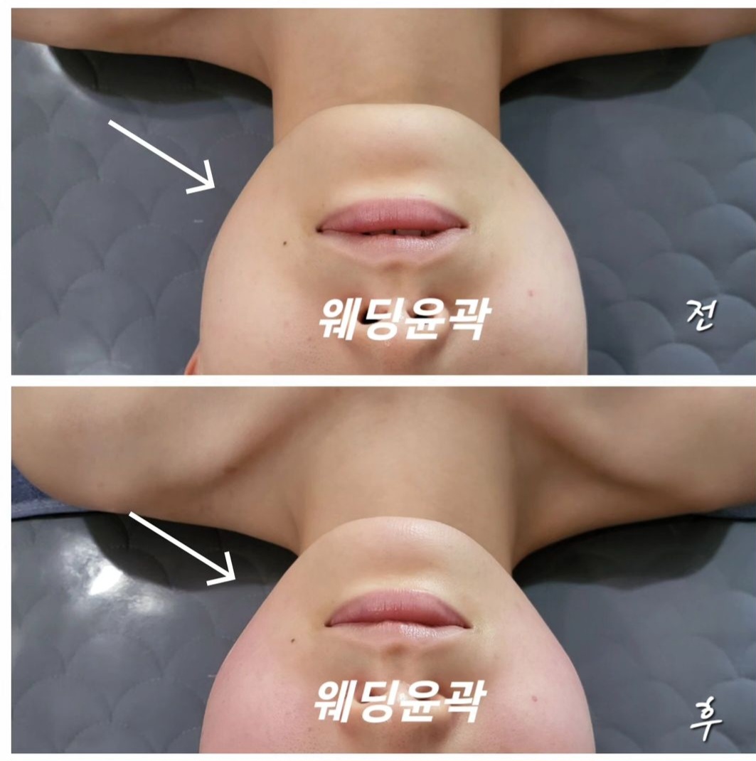미플 가야점