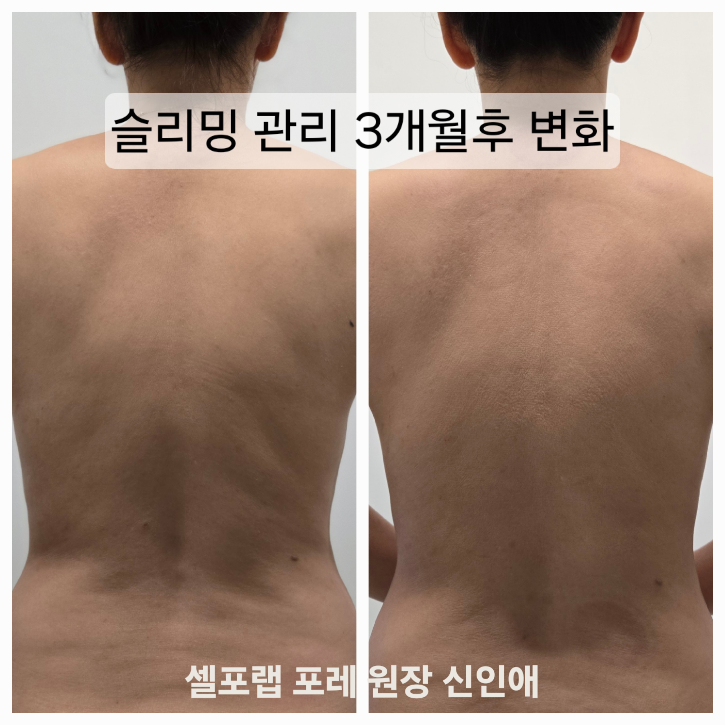 셀포랩 포레