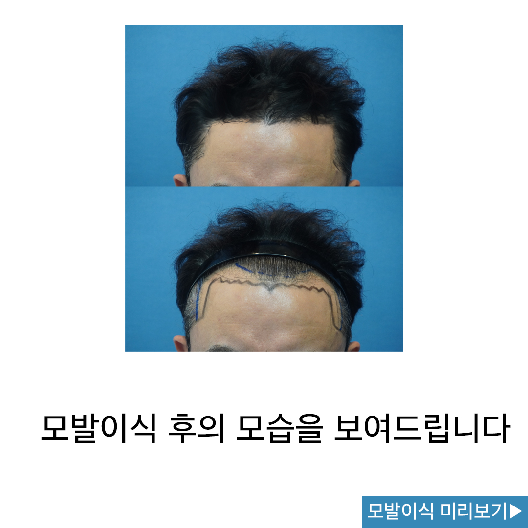 모바름미작의원 대표 이미지