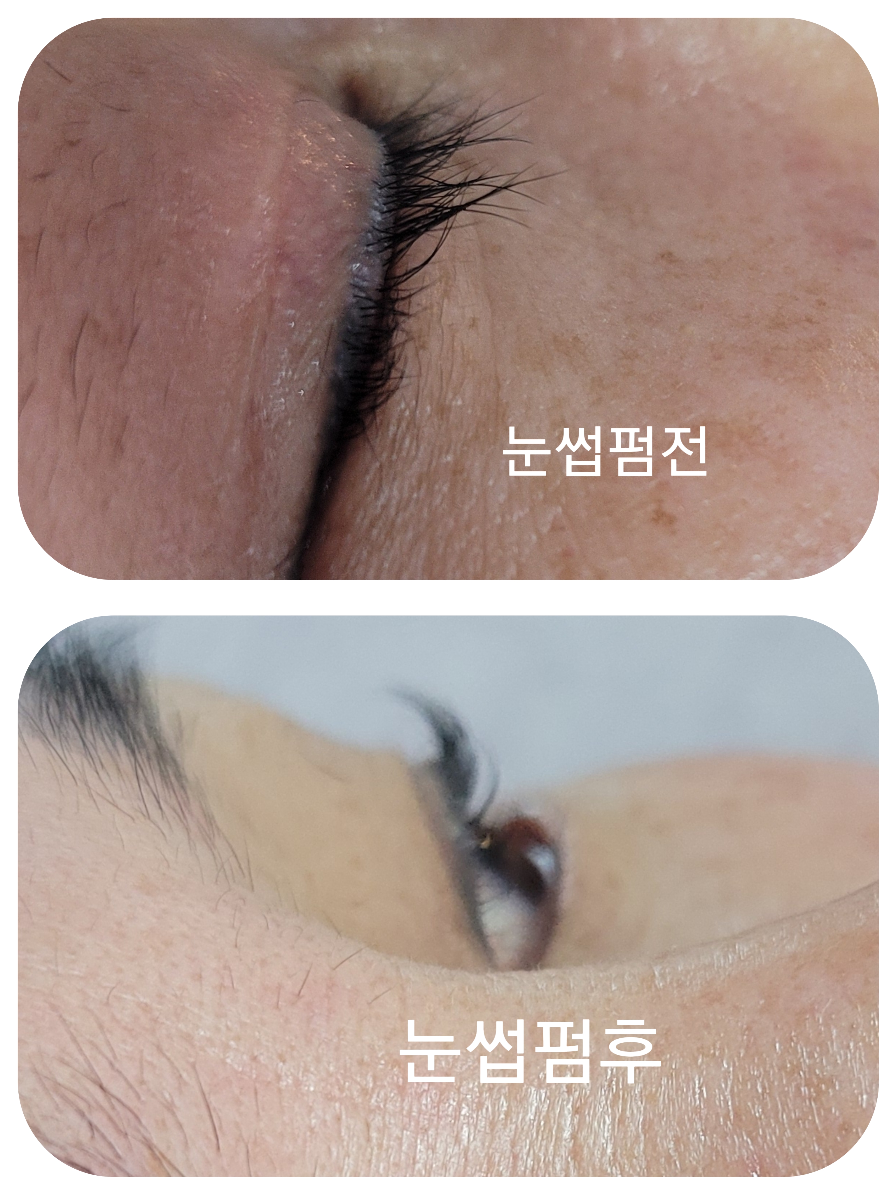 토탈뷰티 주