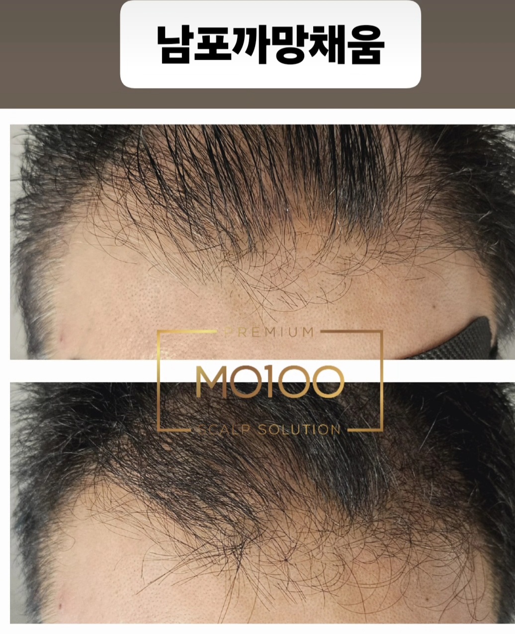 까망채움스칼프 대표 이미지