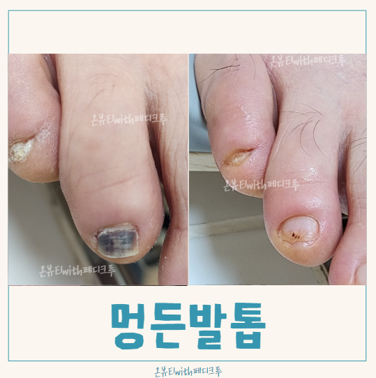 족보