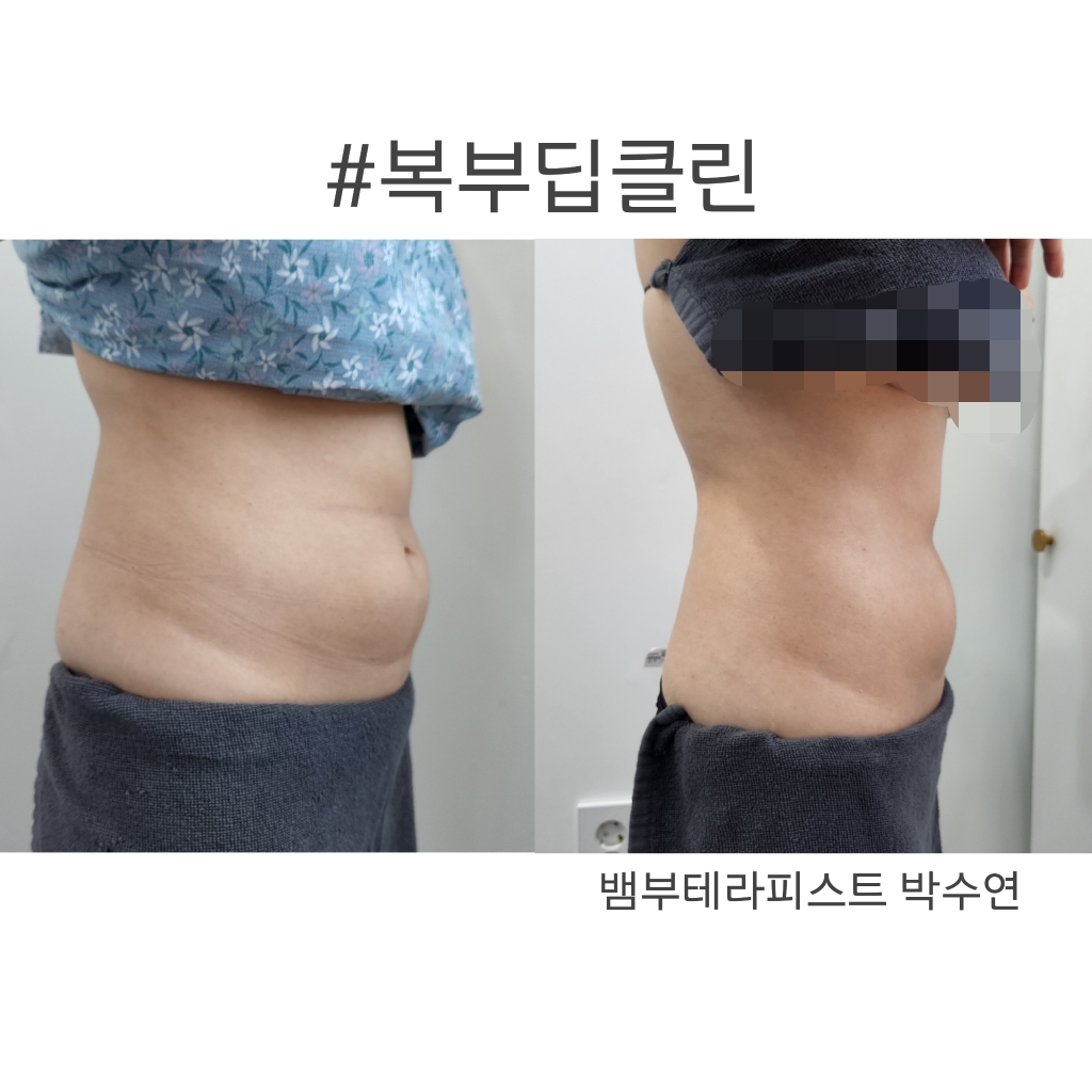 에스테틱 수연