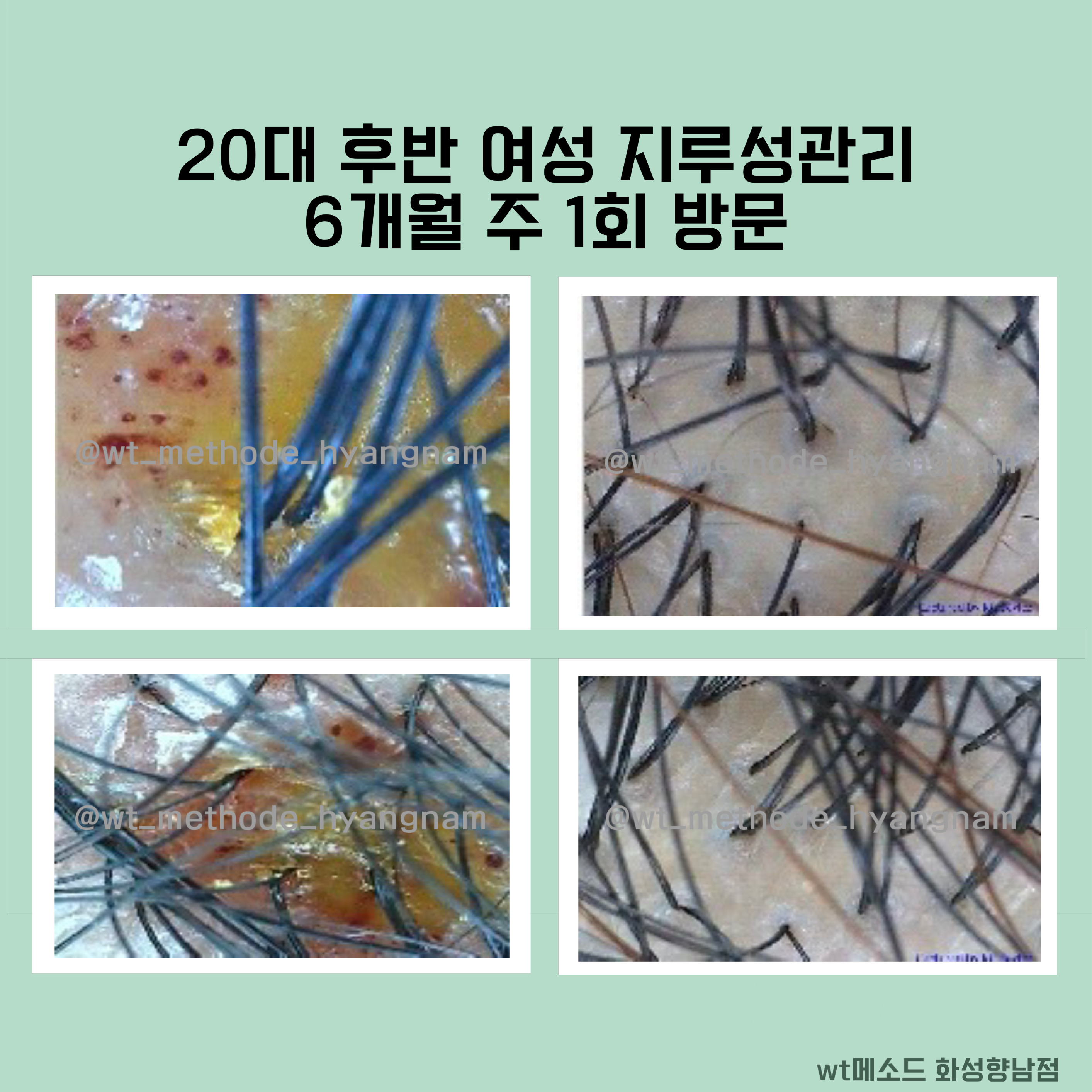 WT메소드 화성향남점