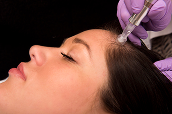 모리셋두피재생센터 당진점 대표 이미지