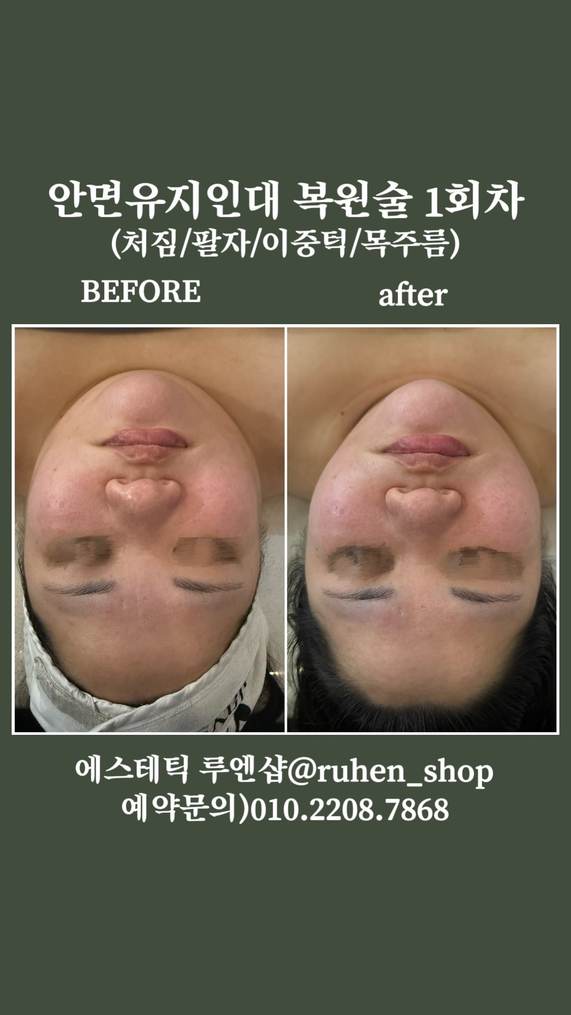 에스테틱 루엔샵