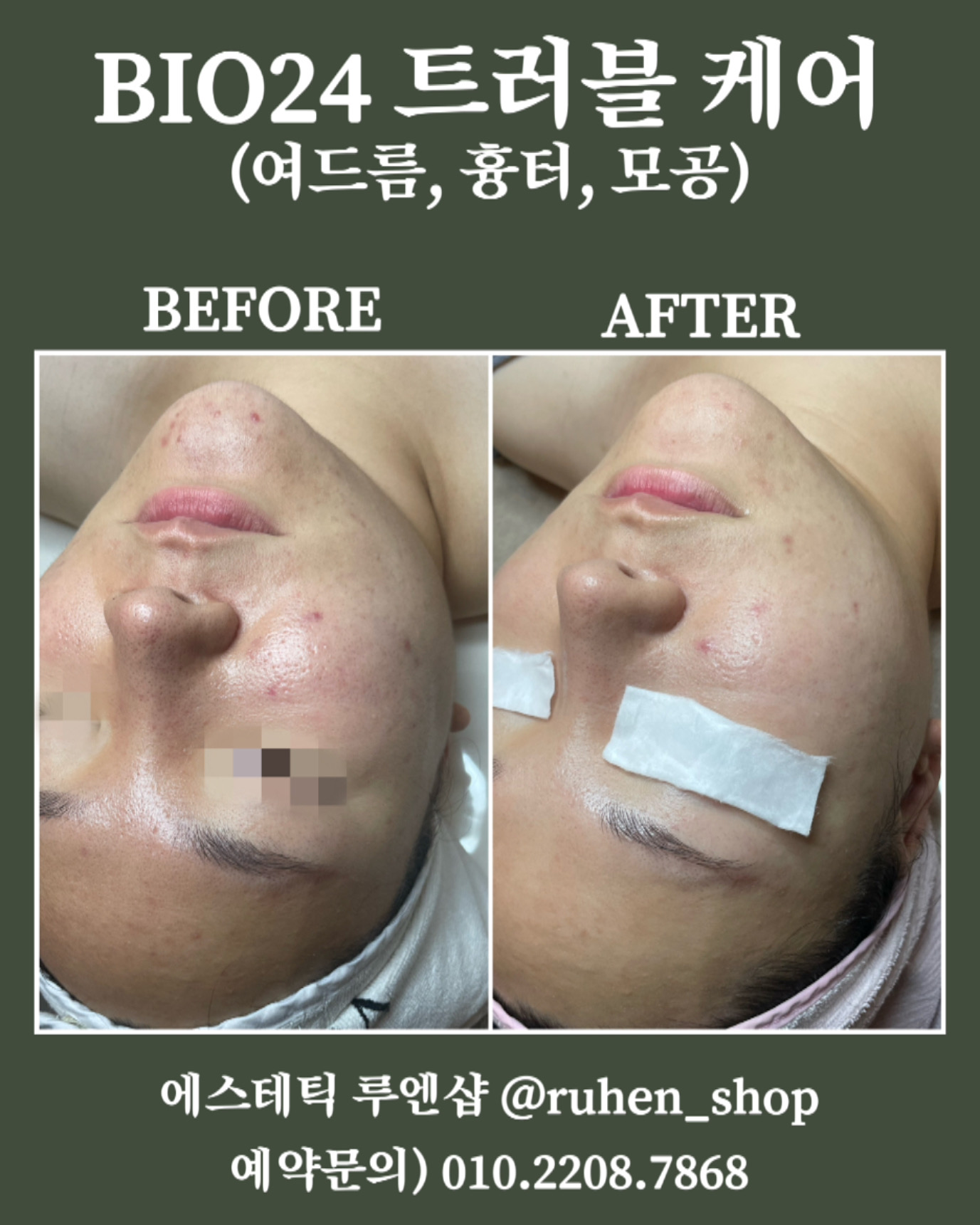 에스테틱 루엔샵
