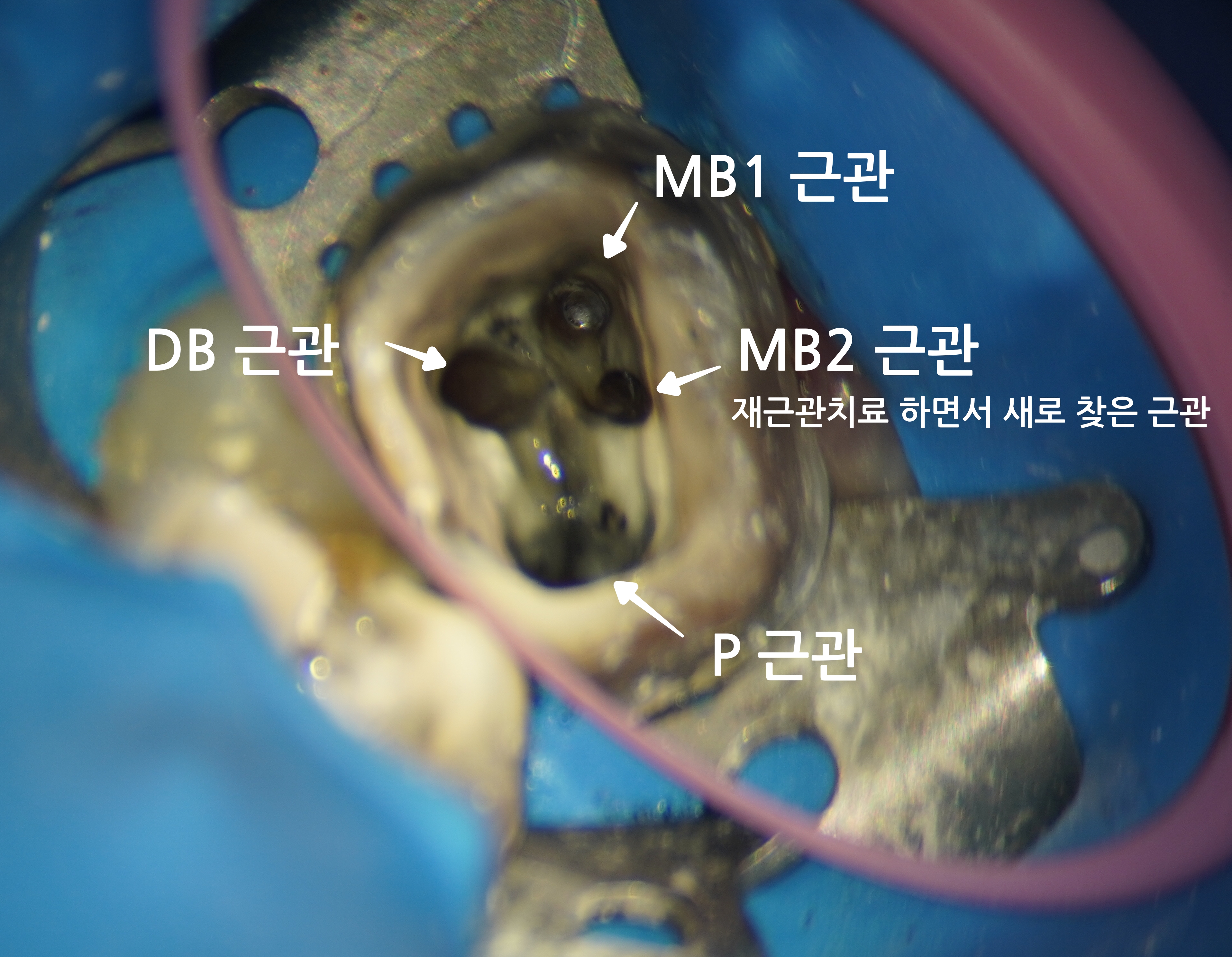 김동건바른치과의원 부평동암 대표 이미지