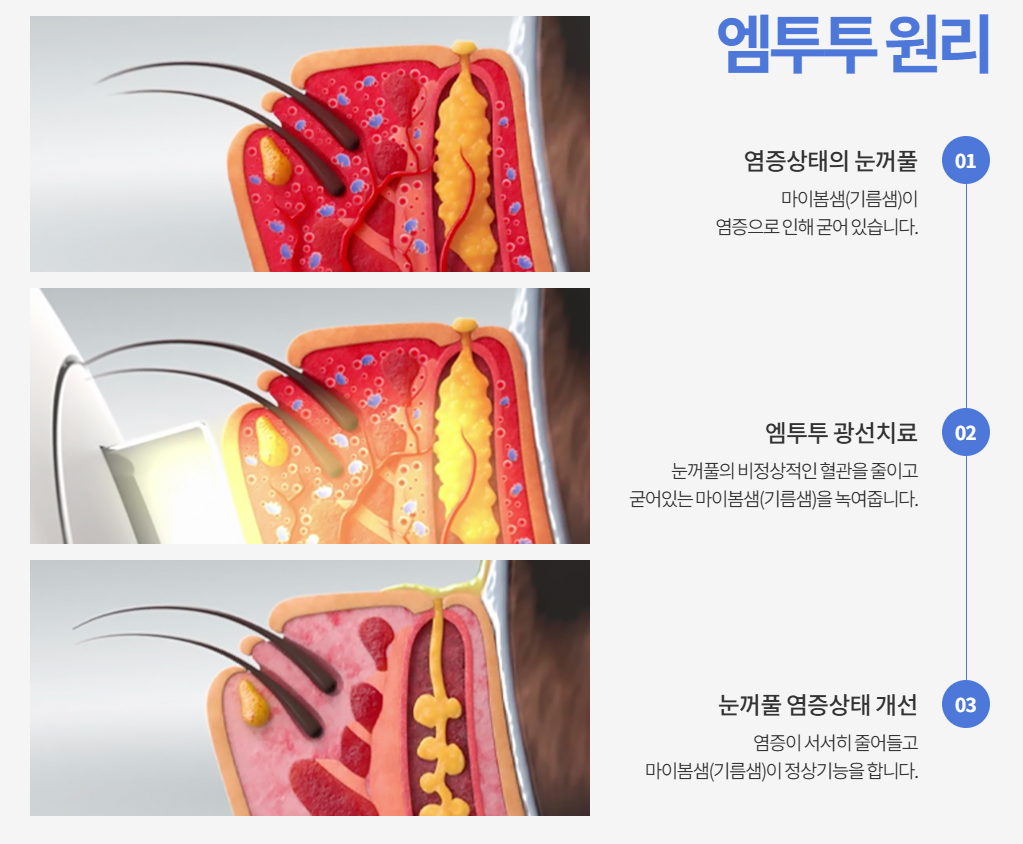 아이굿안과의원 대표 이미지