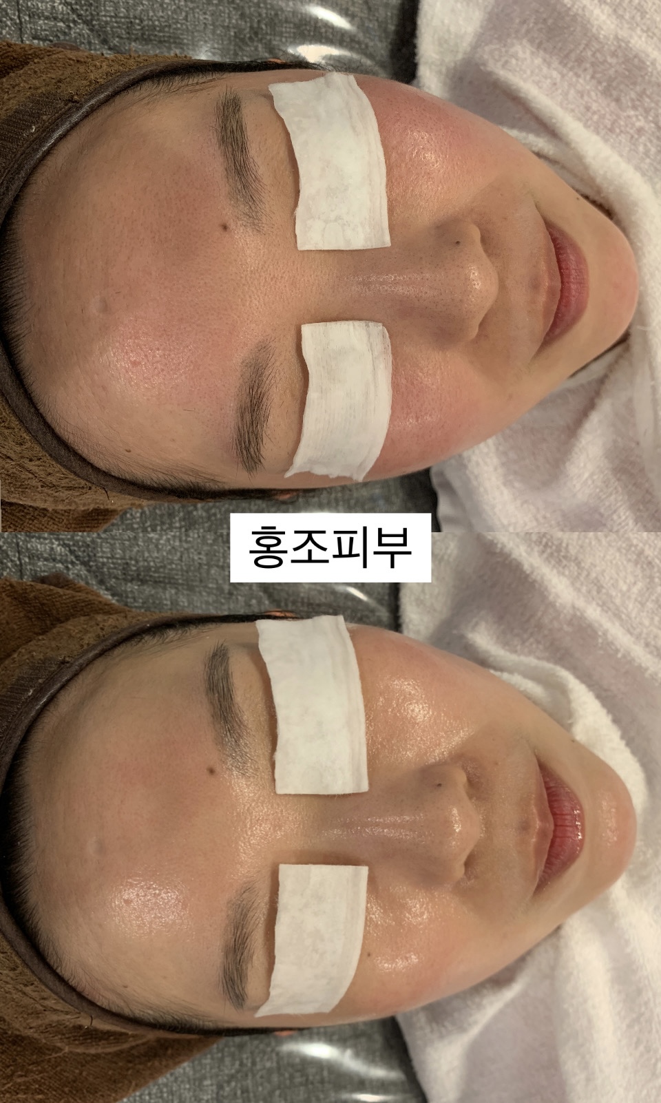 반하다피부