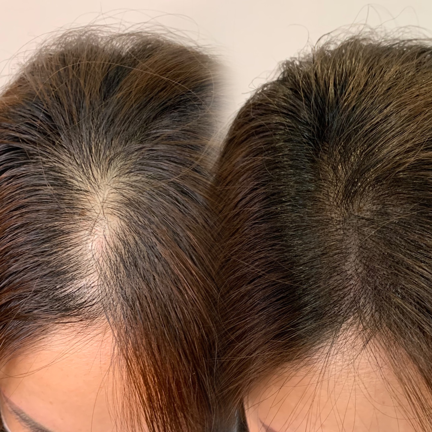 올림래쉬 대표 이미지