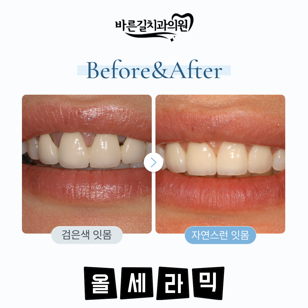 바른길치과의원 대전 대표 이미지