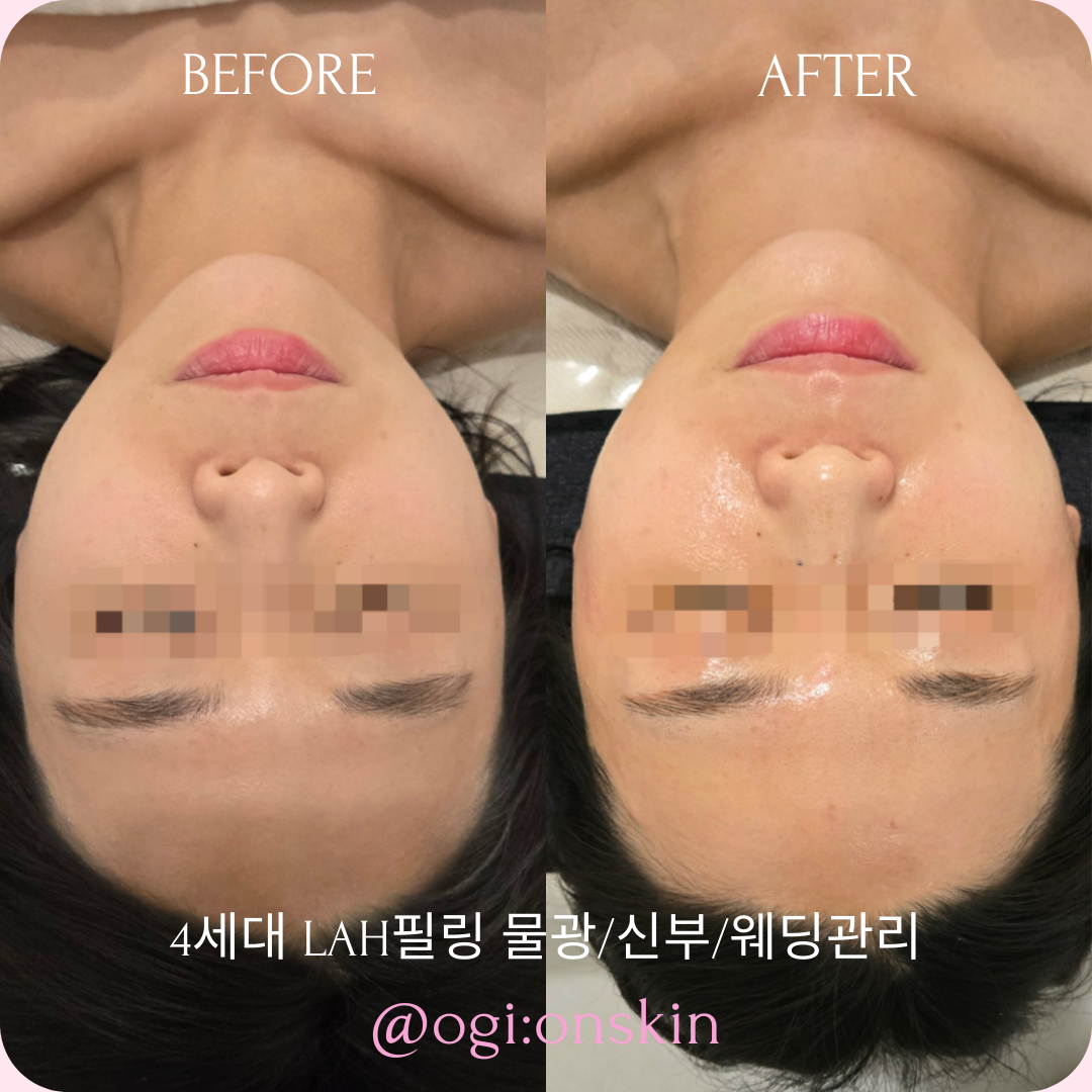 오기온스킨 에스테틱