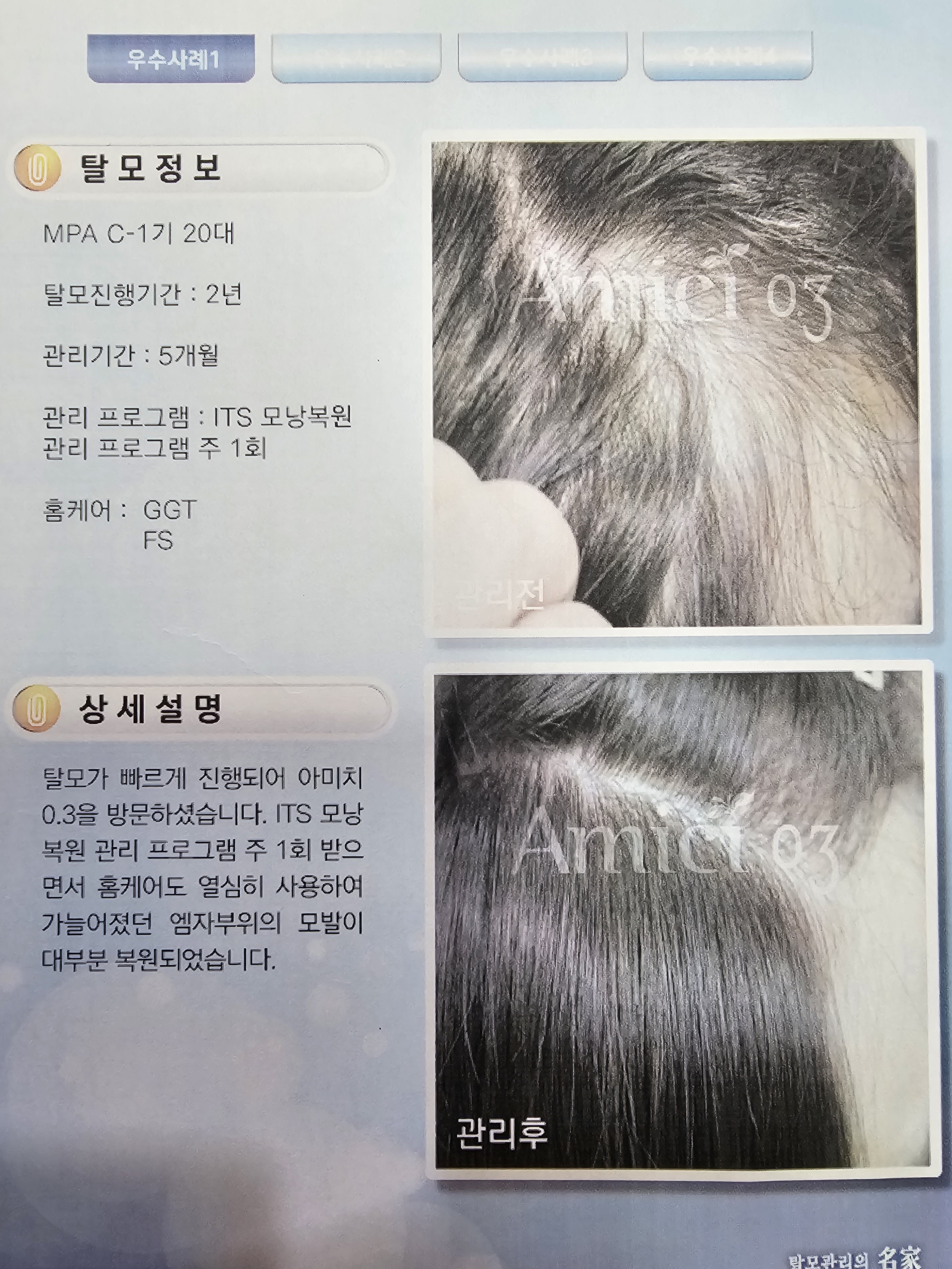 아미치0.3 순천점