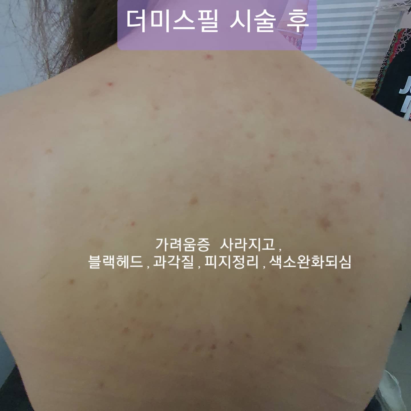 결이고운스킨앤바디