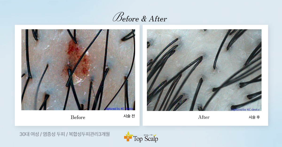 탑스칼프 구로디지털점 대표 이미지