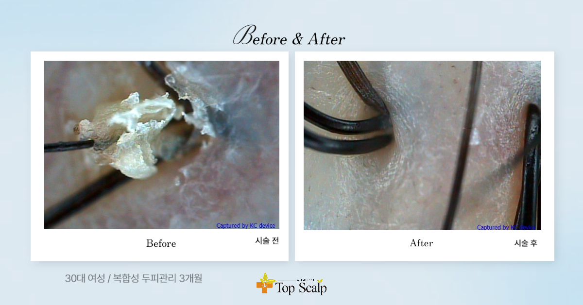 탑스칼프 구로디지털점 대표 이미지