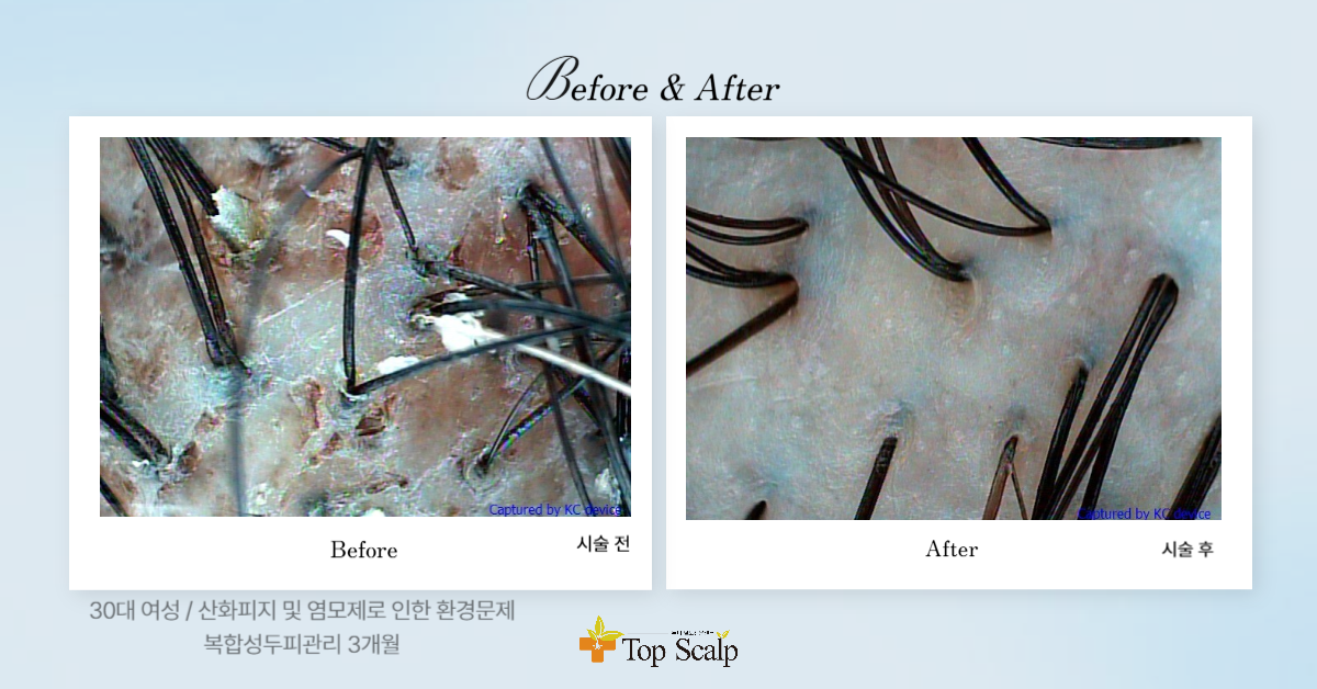탑스칼프 구로디지털점 대표 이미지