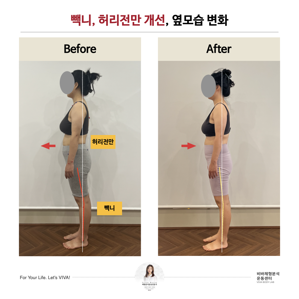 비바체형분석운동센터 강남세곡본점 대표 이미지