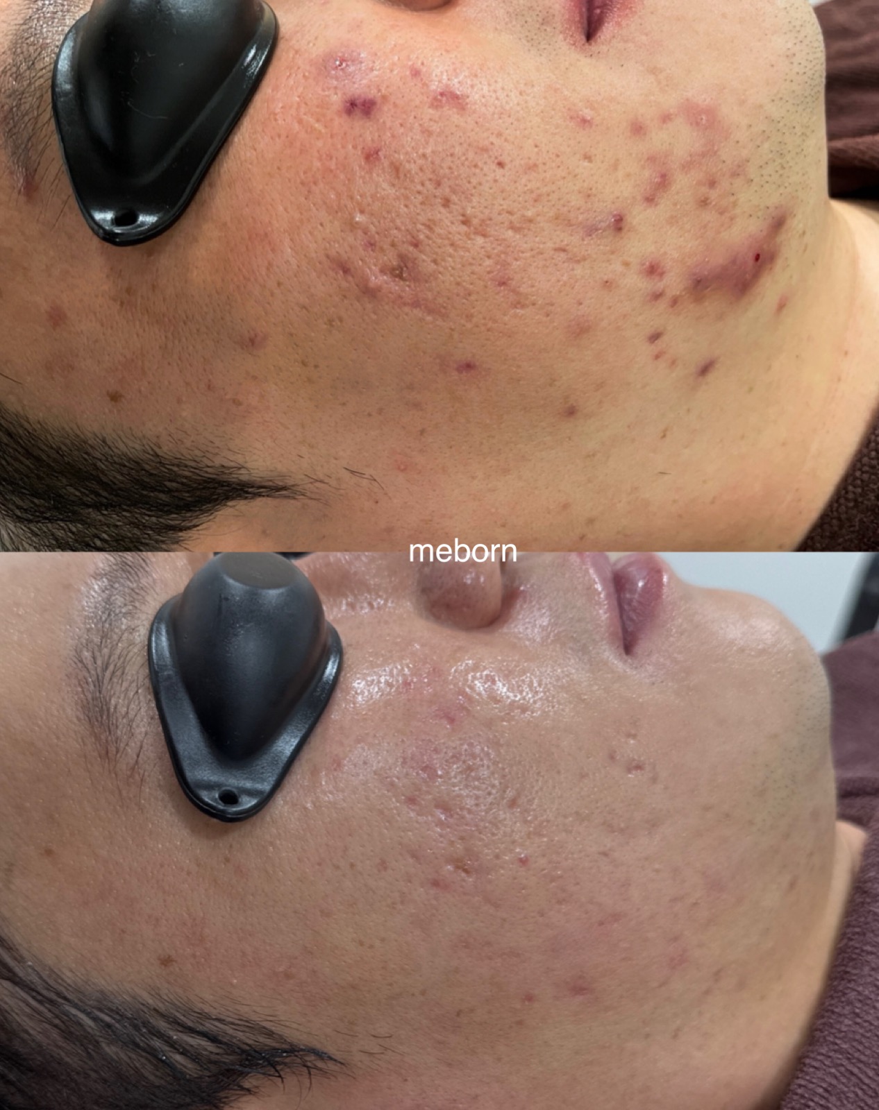 미본에스테틱 대표 이미지