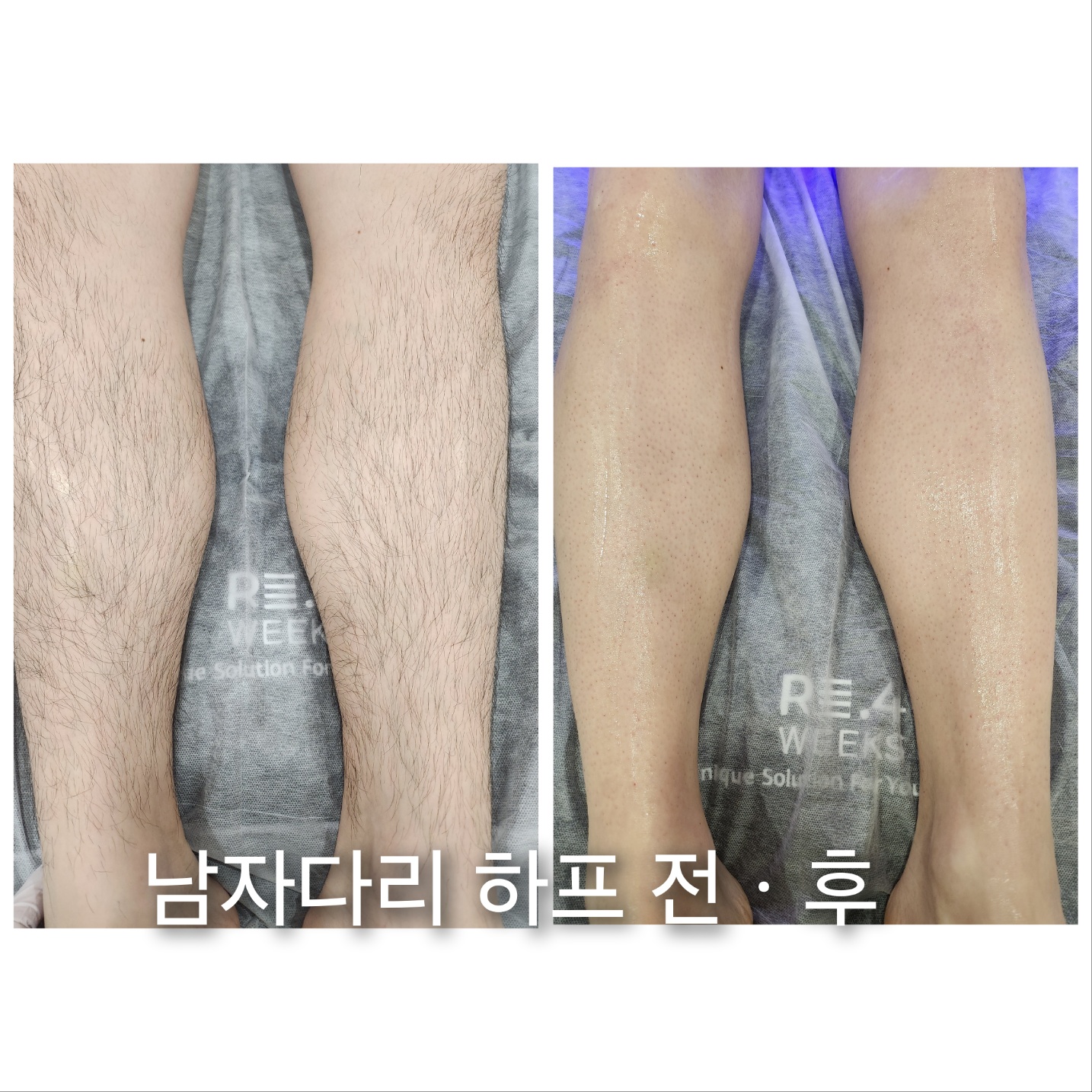 리포윅스 슈가링왁싱 삼산점 대표 이미지