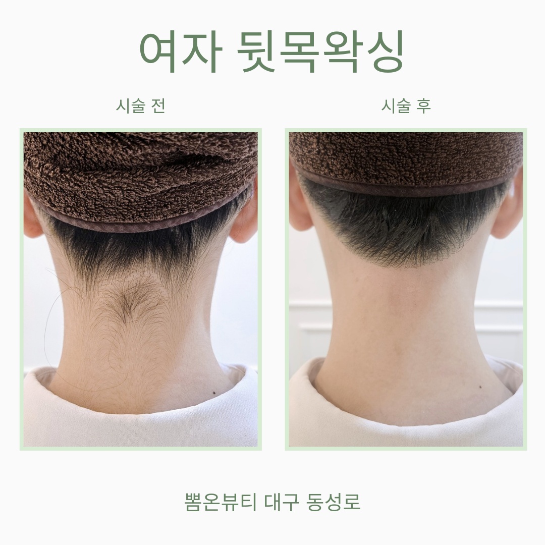 뽐온뷰티 대구본점