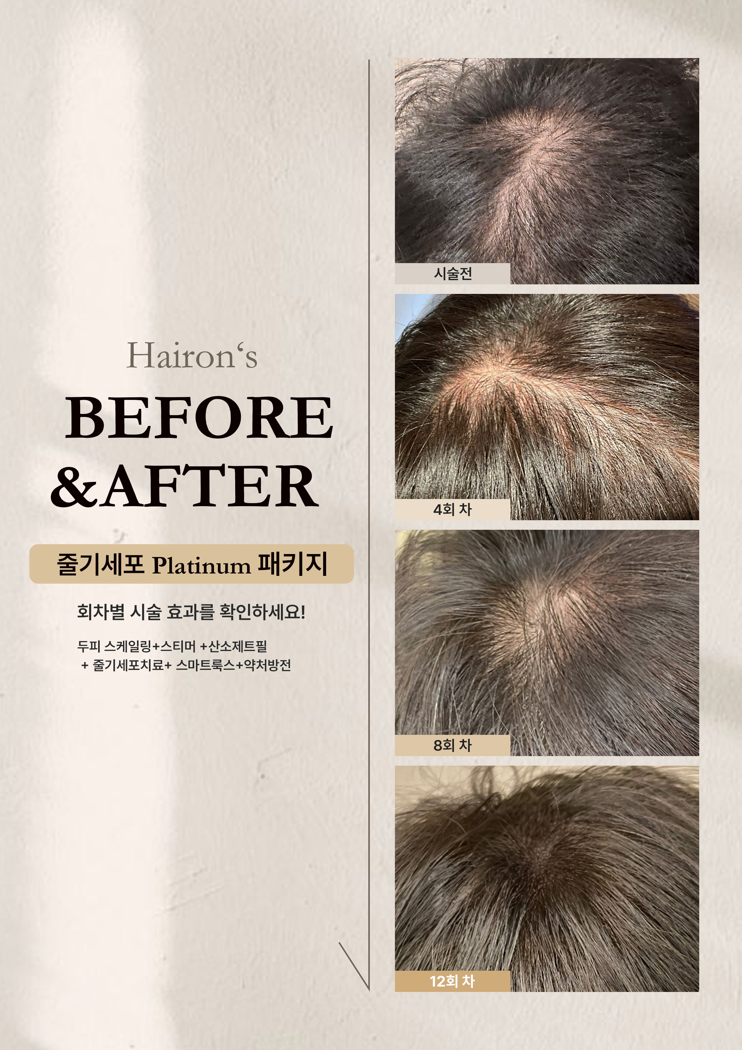 헤어온의원