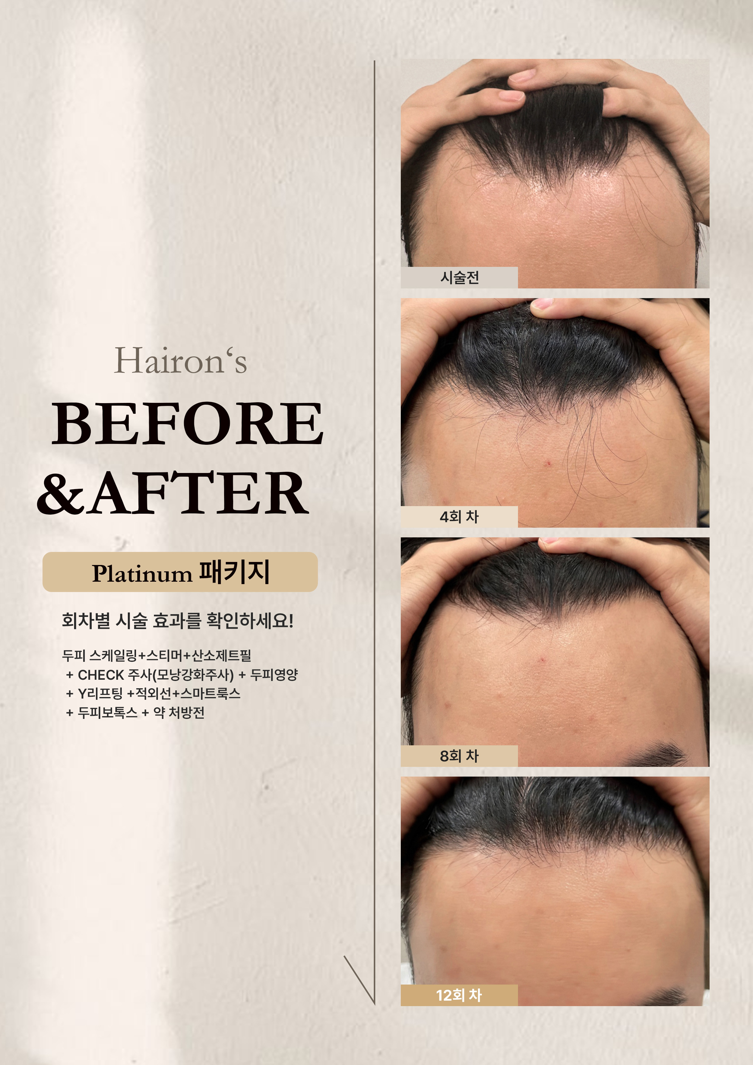 헤어온의원 강남 대표 이미지