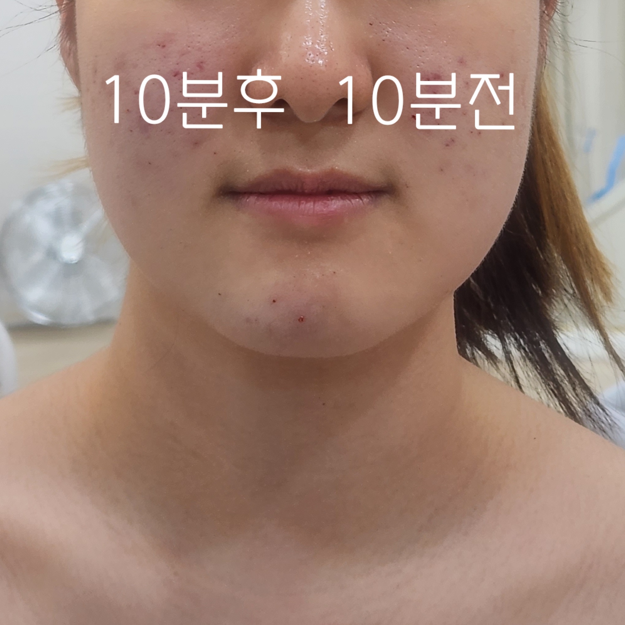 디또뷰티 보라매점