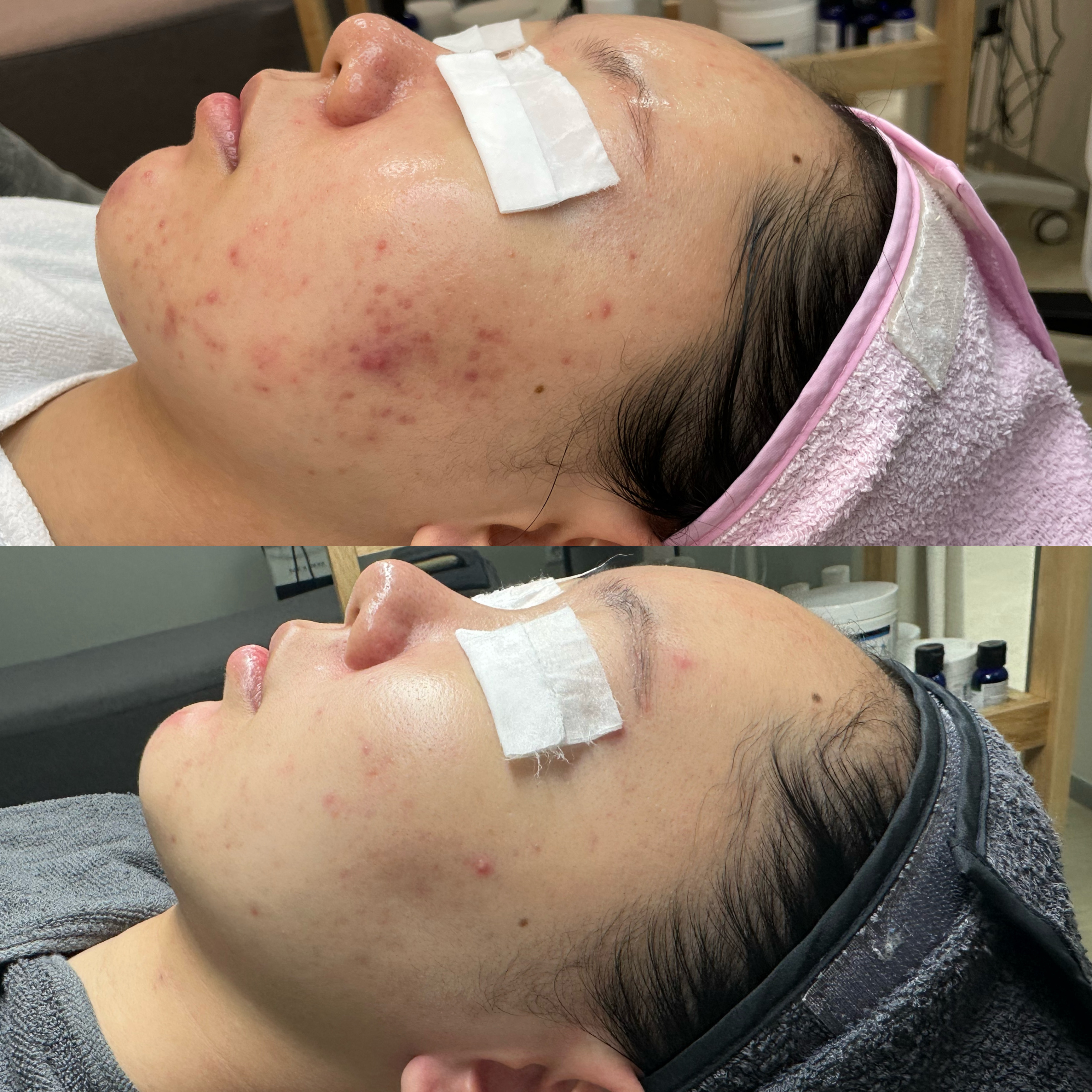 멜로우스킨 대표 이미지