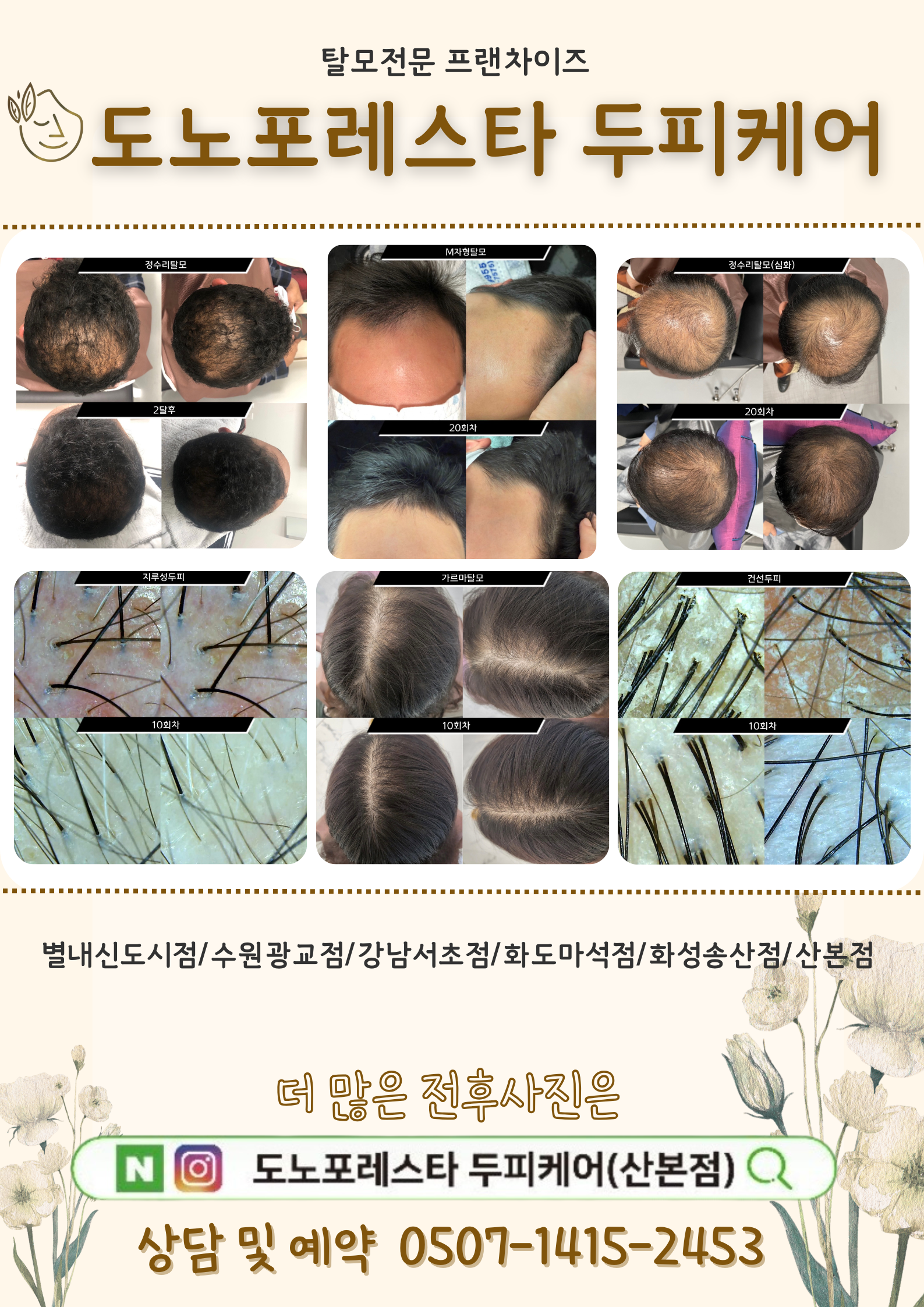 도노포레스타 두피케어 산본점
