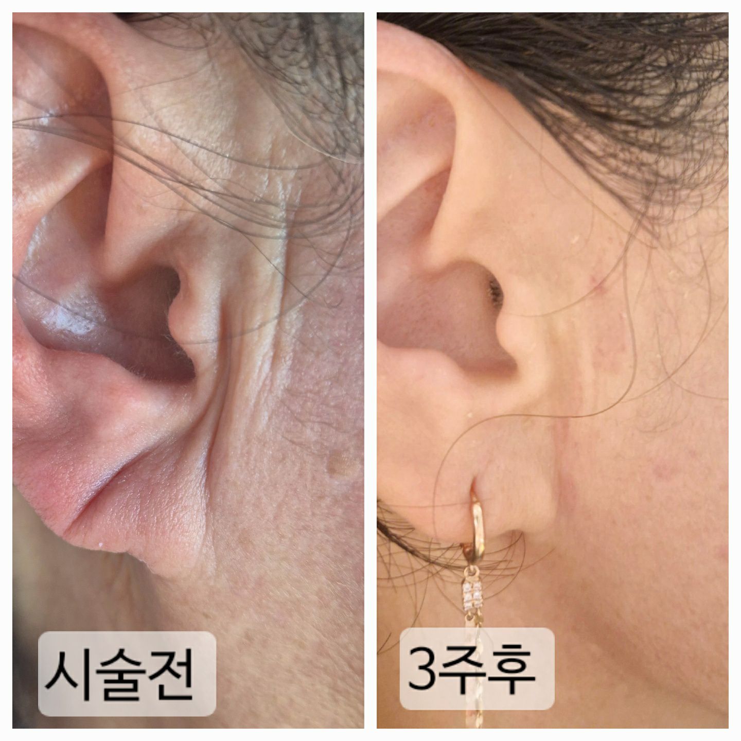 고원장의모공세척테라피 분당점 대표 이미지