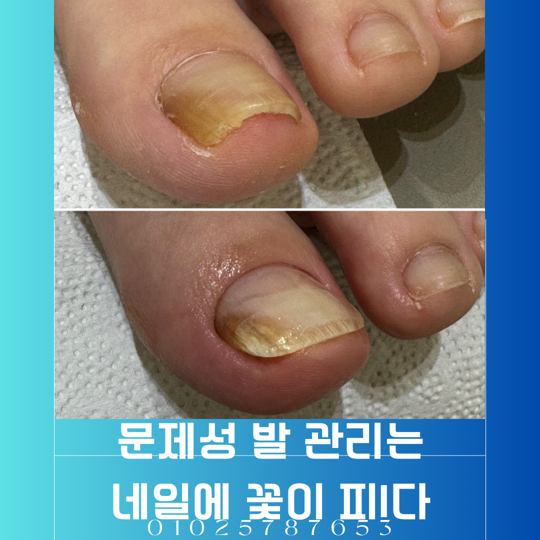 네일에 꽃이피다