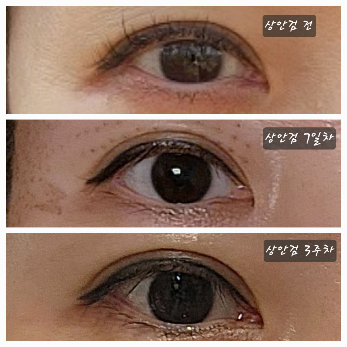 고원장의모공세척테라피 분당점 대표 이미지