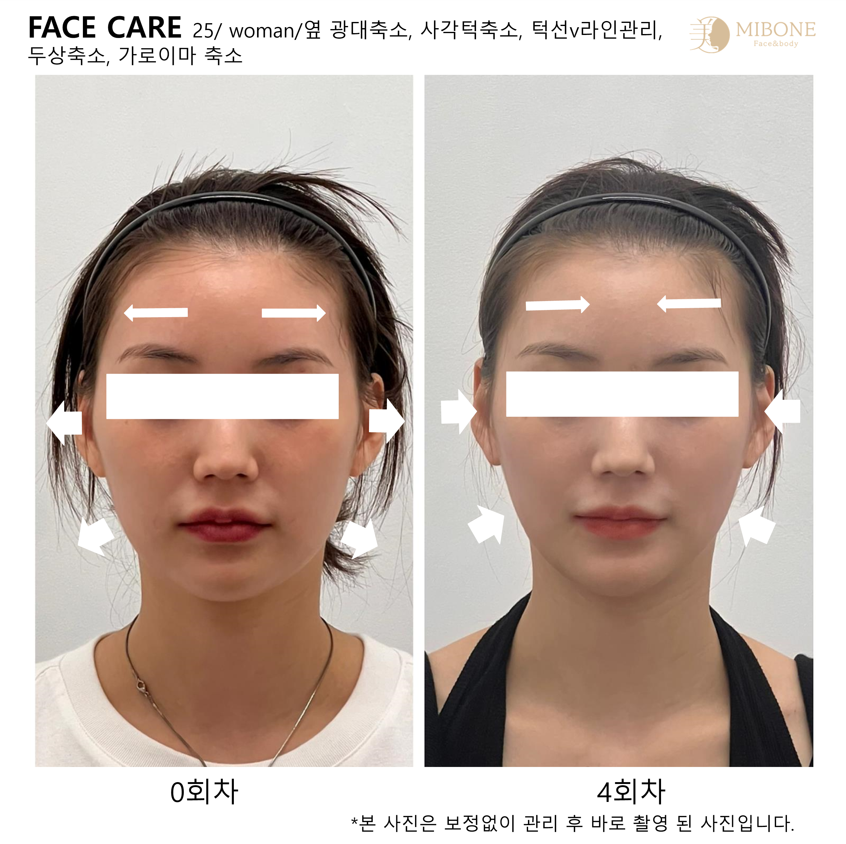 미본 얼굴윤곽관리 강남점 대표 이미지