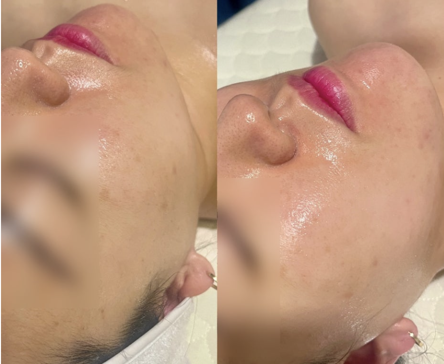 리프트스킨케어 마곡피부관리 대표 이미지