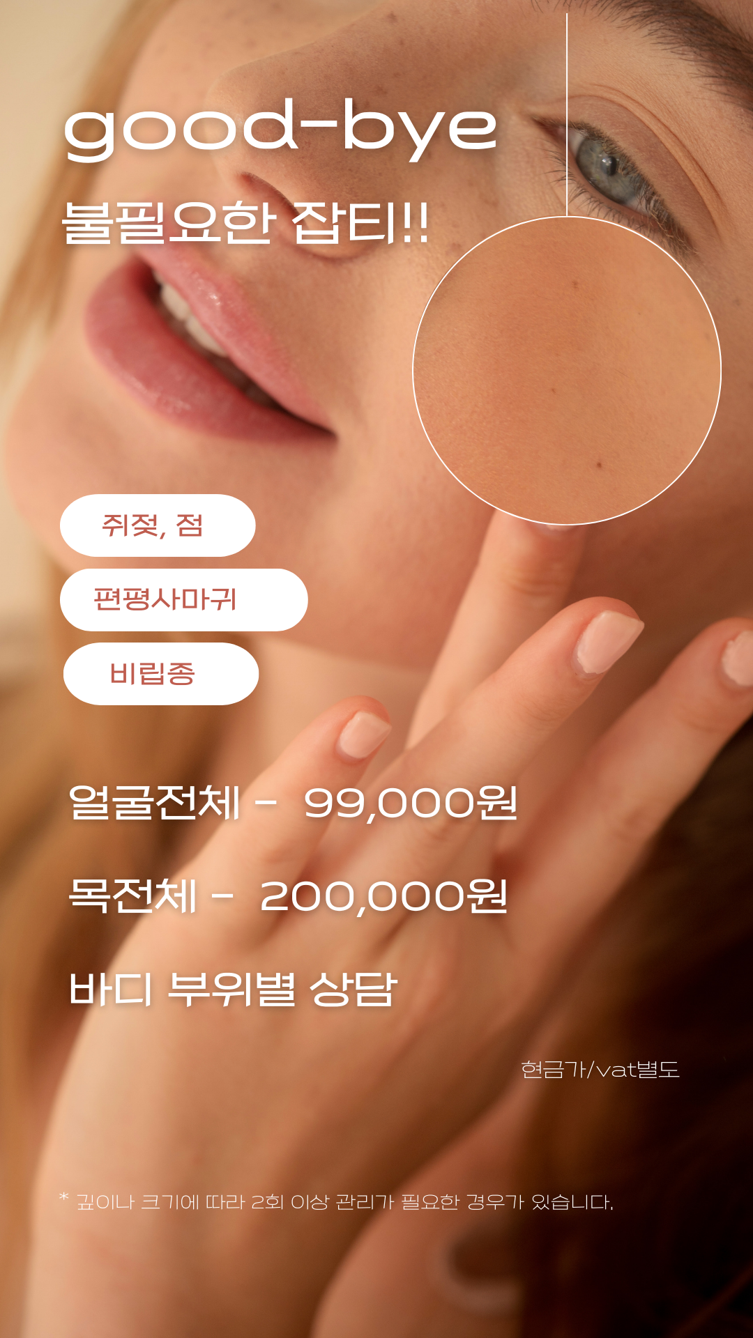 슈가링 무무왁싱