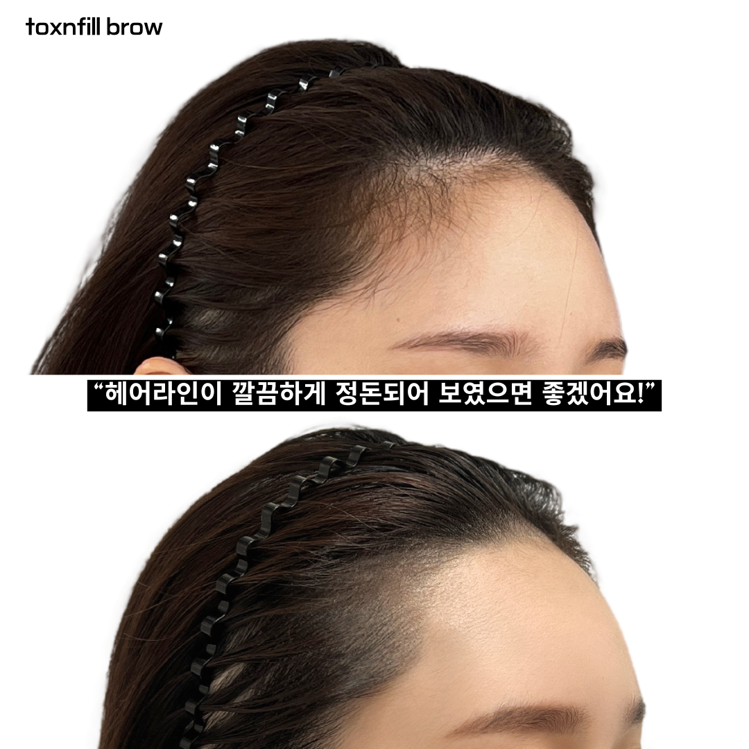 톡스앤필브로우 강남본점 대표 이미지