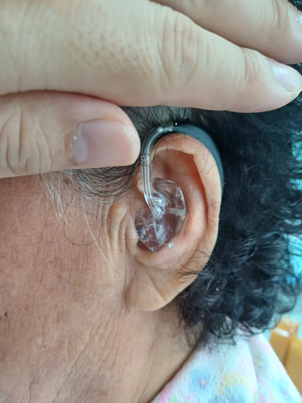 독일보청기 대표 이미지