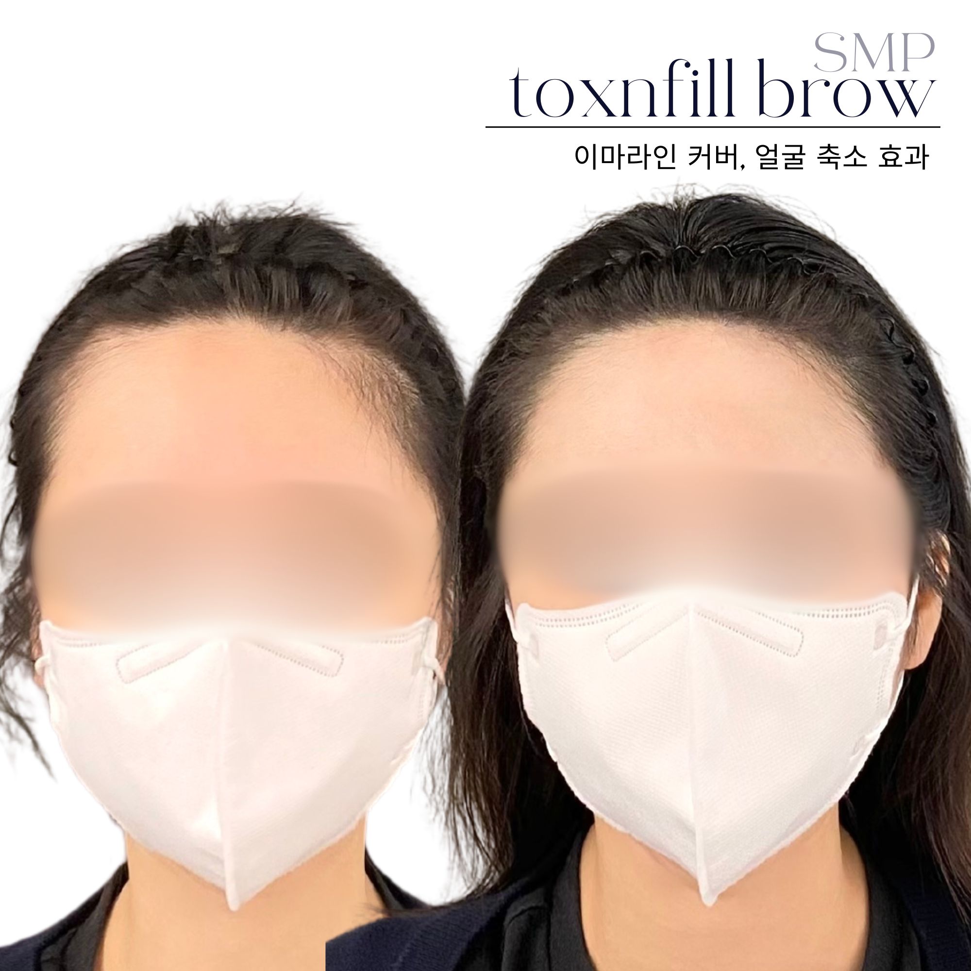 톡스앤필브로우 강남본점 대표 이미지