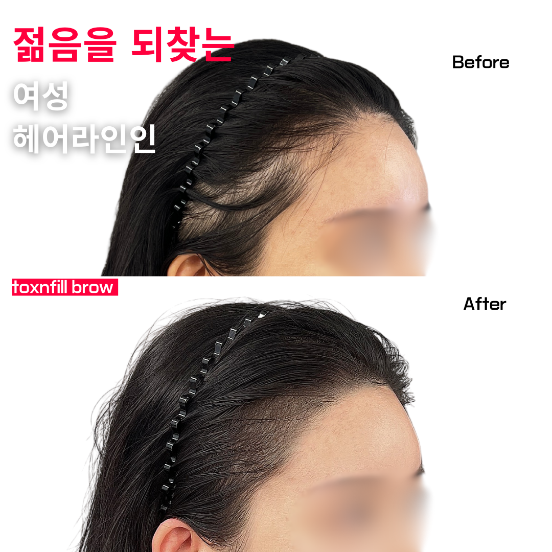 톡스앤필브로우 대표 이미지