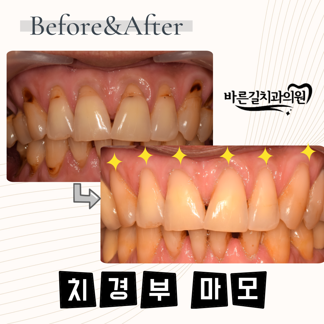 바른길치과의원 대표 이미지