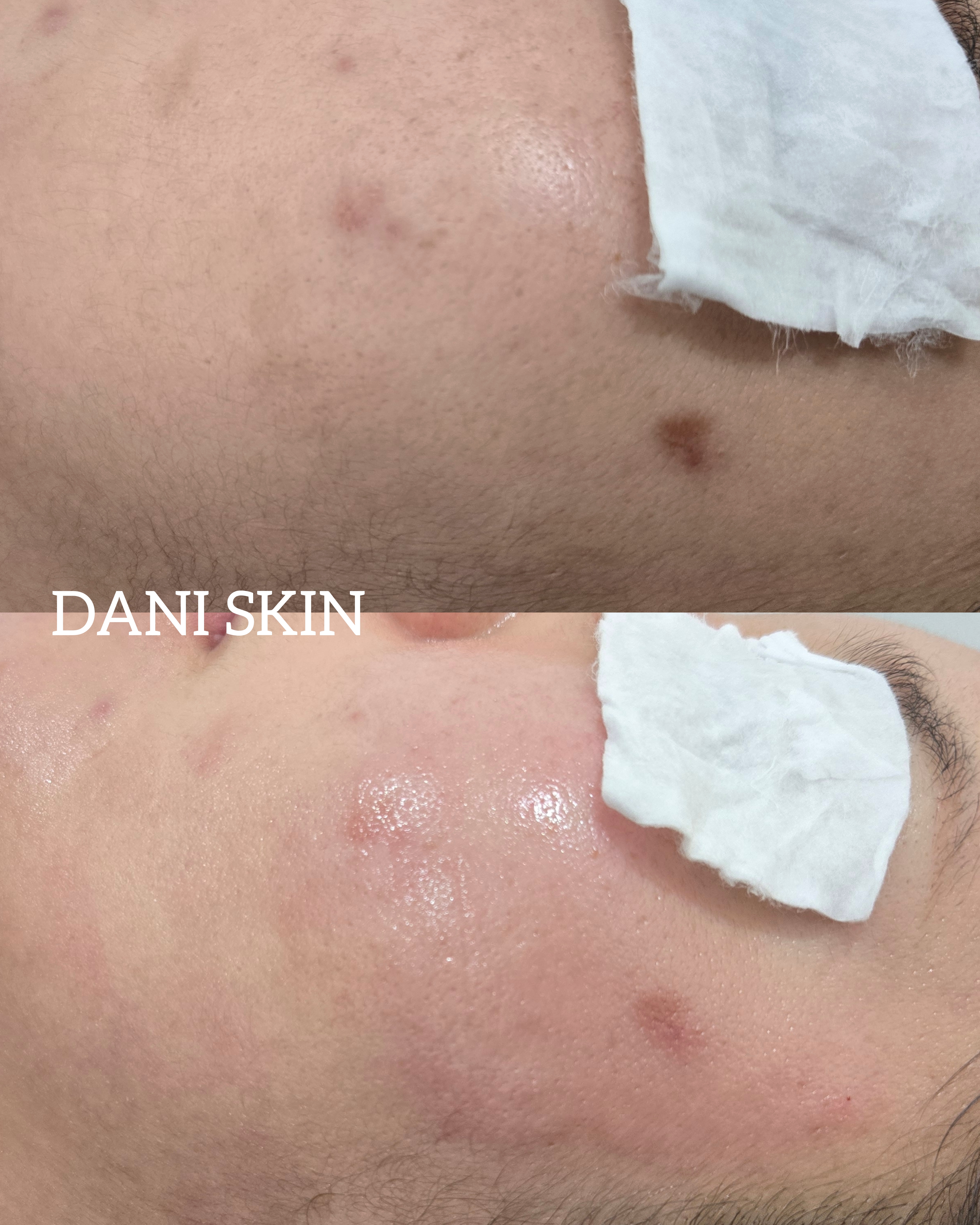 다니스킨 대표 이미지