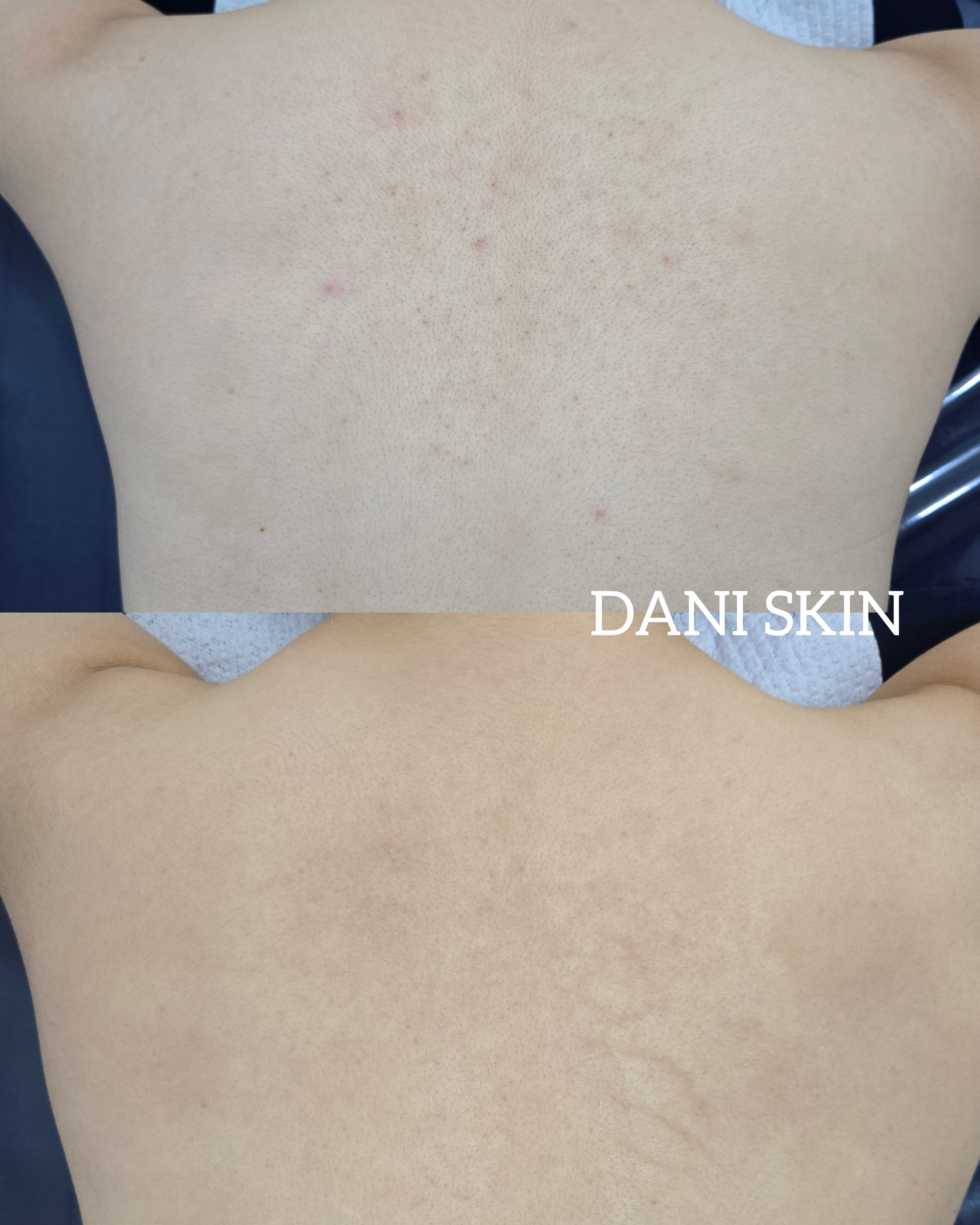 다니스킨 대표 이미지