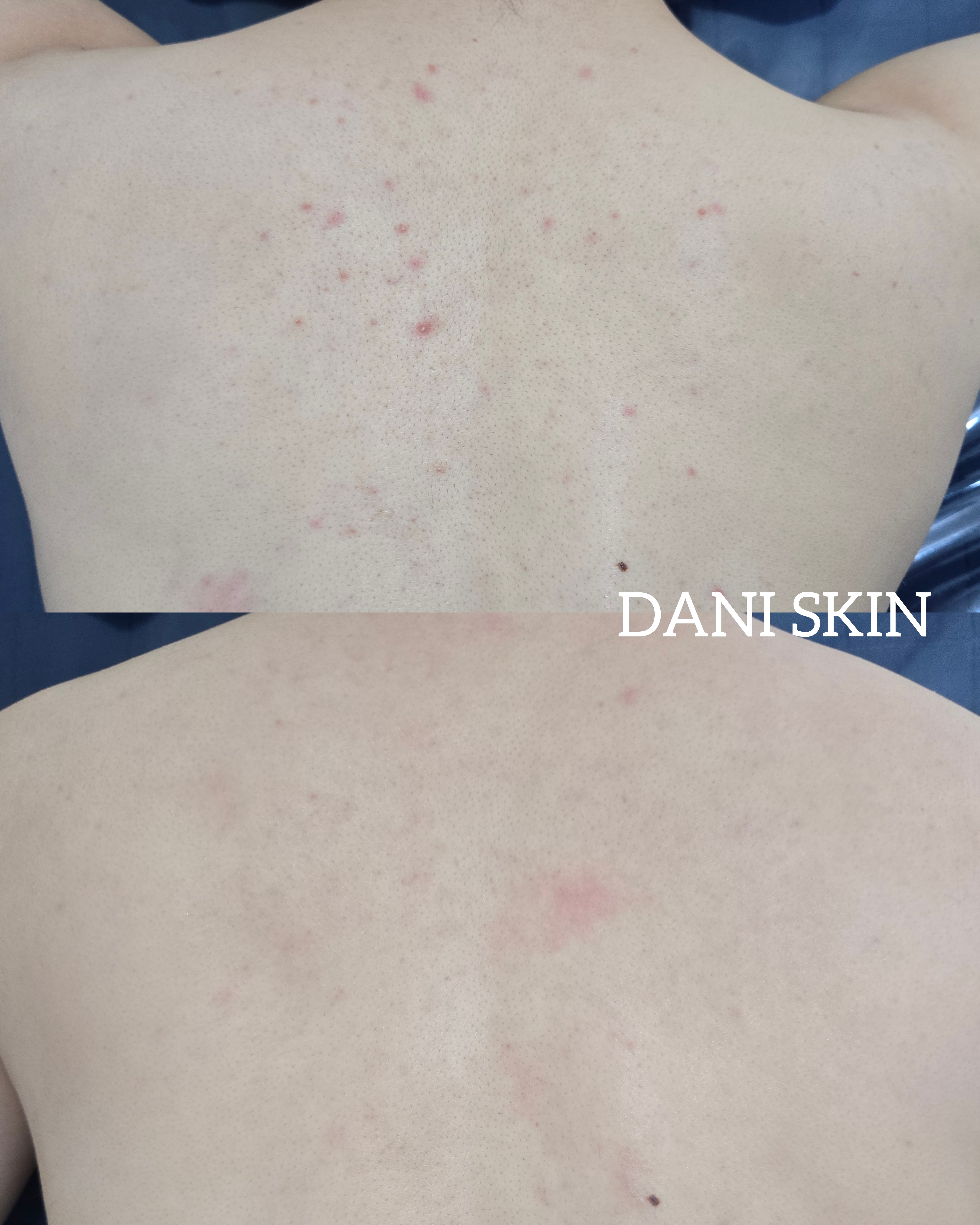 다니스킨 대표 이미지