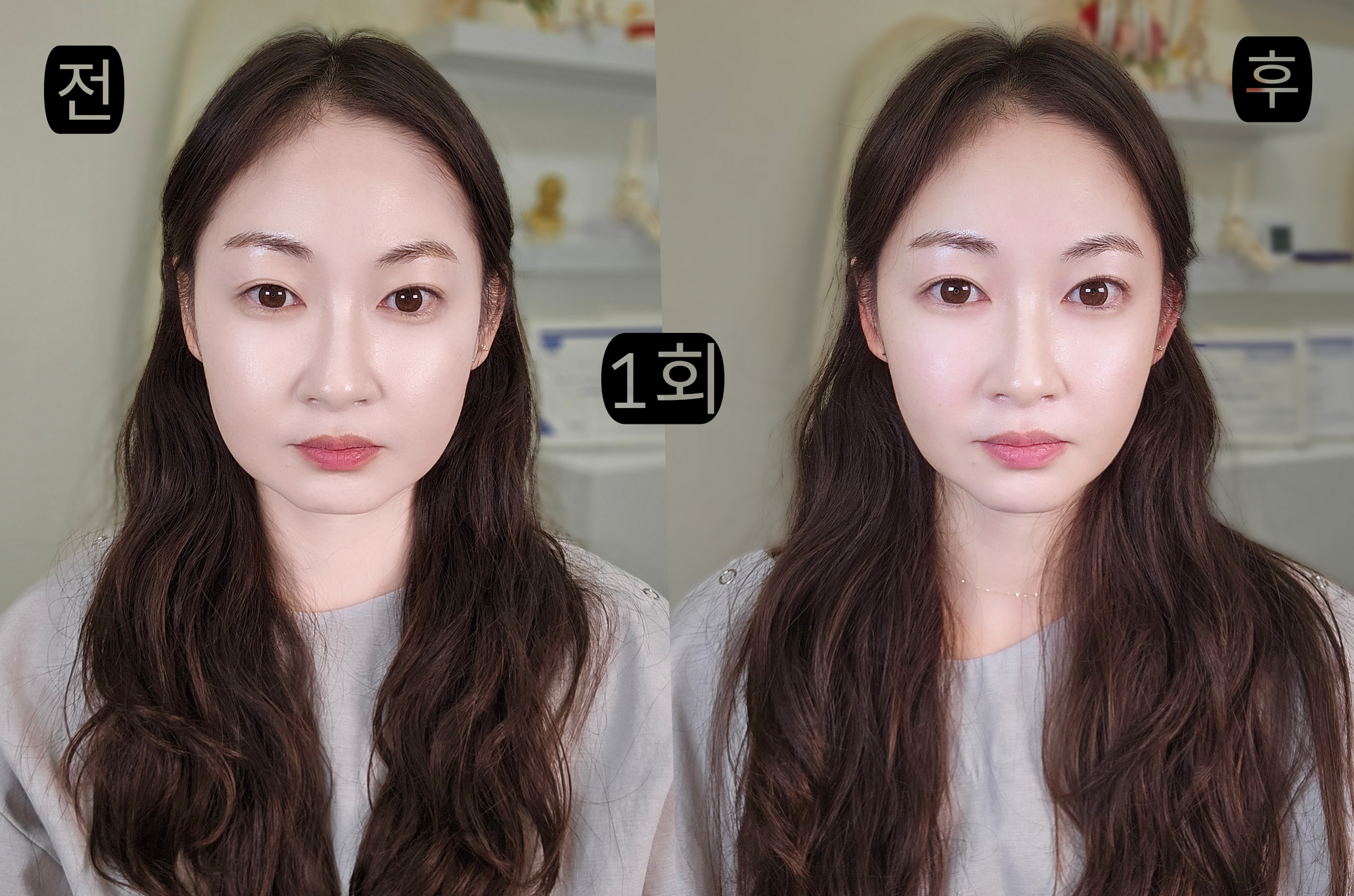 리밸런스멀리건 대표 이미지