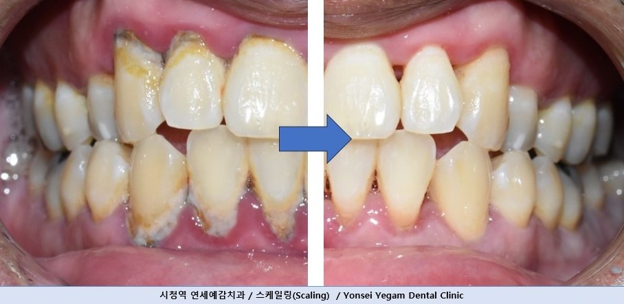 연세예감치과의원 대표 이미지
