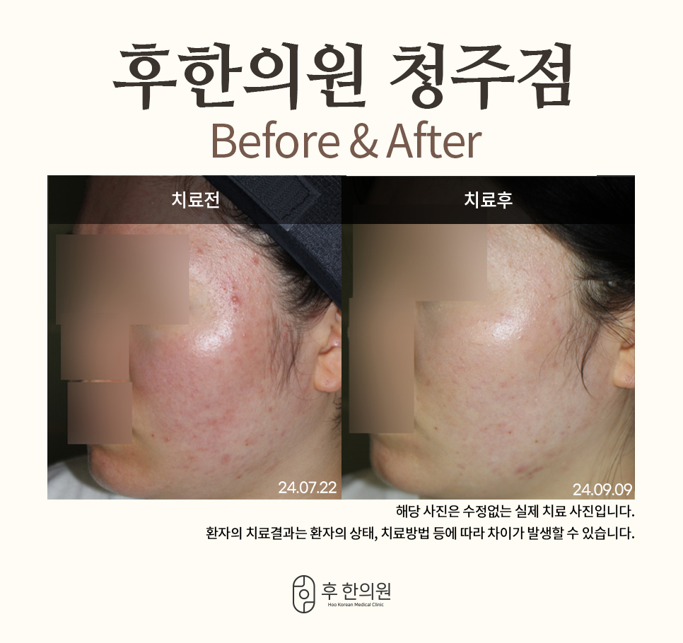 후한의원 청주점 대표 이미지