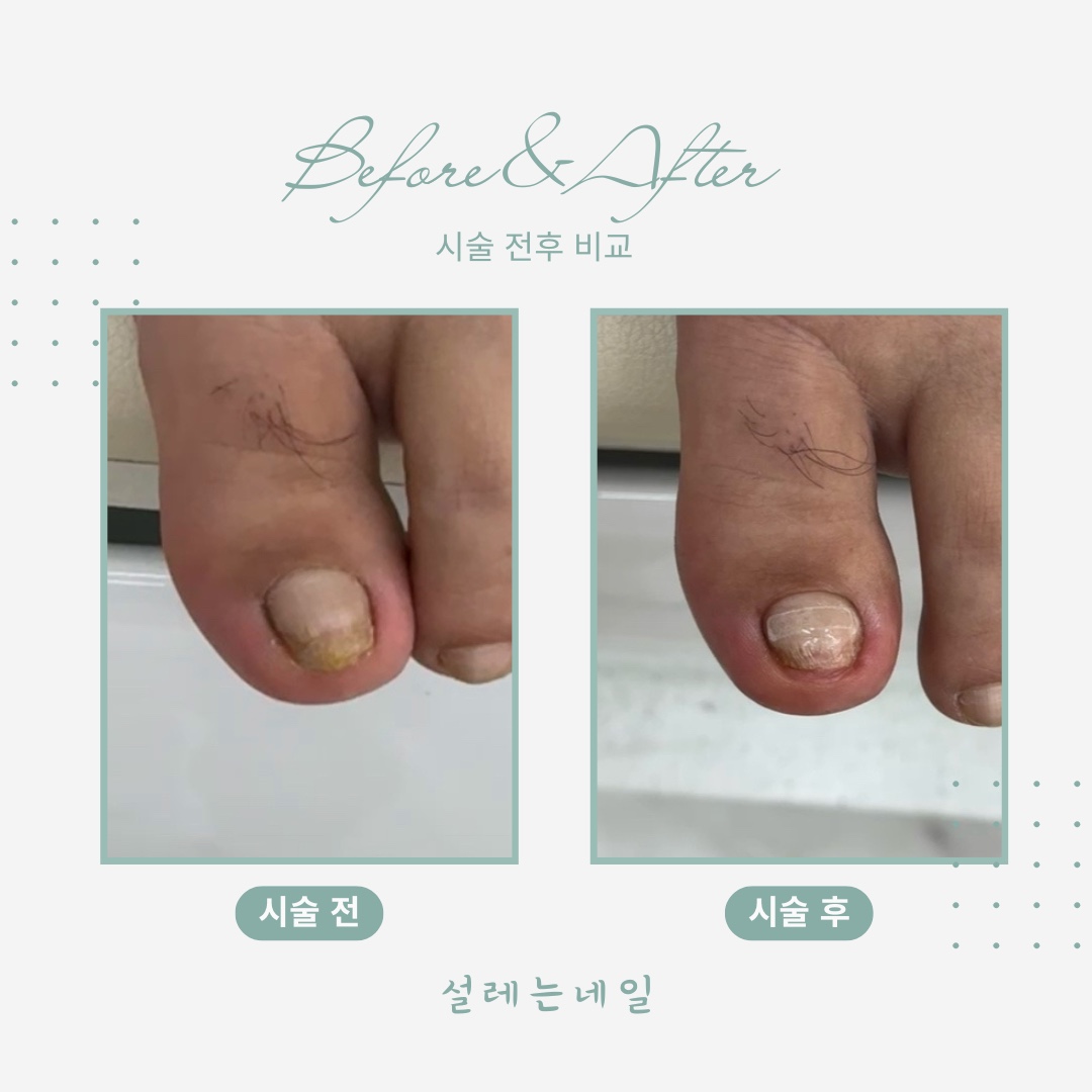 설레는 네일 대표 이미지